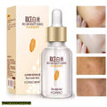 Rice Essence Serum - 15ml, Glass Bottle, Gold Dropper